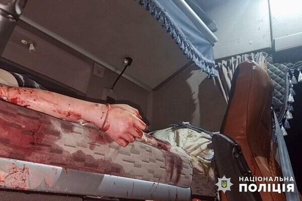 Враг атаковал Одесский район баллистикой: есть раненые и погибшие, среди жертв – десятилетняя девочка (обновлено) Враг атаковал Одесский район баллистикой: есть раненые и погибшие, среди жертв – десятилетняя девочка (обновлено)